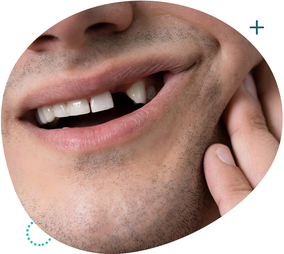 http://mckinnondental.com.au/wp-content/uploads/2021/12/replace-missing-teeth.jpg
